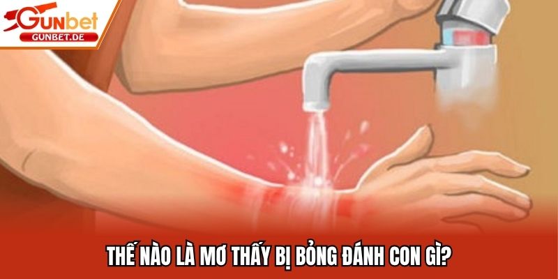 Thế nào là mơ thấy bị bỏng đánh con gì?